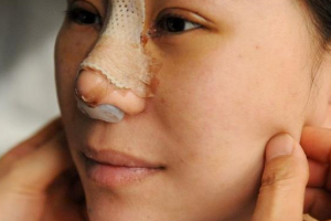 黑龍江瑞麗植發(fā)中心怎么樣附全新價格表(價目表)