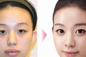 廣東博士園植發(fā)怎么樣附全新價(jià)格表(價(jià)目表)