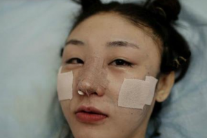 杭州科發(fā)源植發(fā)怎么樣附全新價(jià)格表(價(jià)目表)