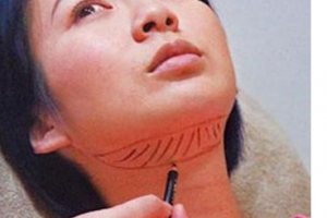 深圳流花醫(yī)院脫發(fā)植發(fā)科怎么樣附全新價(jià)格表(價(jià)目表)