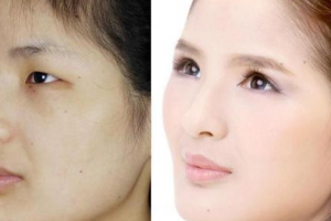 廣西南寧貞韓植發(fā)怎么樣附全新價格表(價目表)