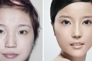 武警遼寧省總隊醫(yī)院植發(fā)中心怎么樣附全新價格表(價目表)