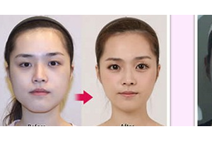 廣西武警總隊醫(yī)院植發(fā)中心怎么樣附全新價格表(價目表)