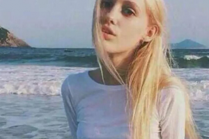 浙江大學醫(yī)學院附屬醫(yī)院整形外科整形價格表一覽及醫(yī)院介紹