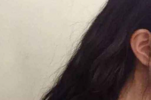 福州渙美醫(yī)療美容門診部整形價(jià)格表一覽及醫(yī)院介紹