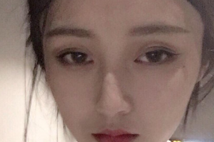 上海文峰醫(yī)療美容門診部整形價(jià)格表一覽及醫(yī)院介紹