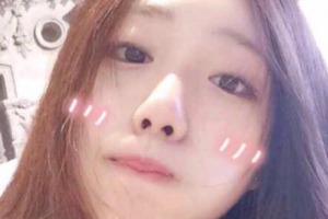 韓國BIO整形外科整形價格表一覽及醫(yī)院介紹