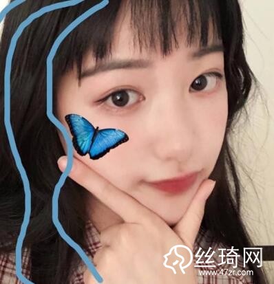 大連光普整形醫(yī)院整形價(jià)格表一覽及醫(yī)院介紹