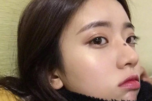 陜西省友誼醫(yī)院整形科整形價格表一覽及醫(yī)院介紹