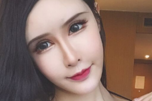 長春榆樹陳偉醫(yī)療美容診所整形價(jià)格表(價(jià)目表)一覽及醫(yī)院介紹