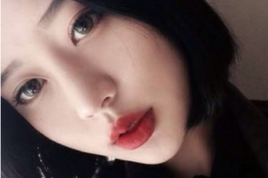 廣西人民醫(yī)院整形美容激光中心整形價(jià)格表(價(jià)目表)全新發(fā)布