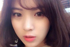 張家港市第一人民醫(yī)院燒傷整形科整形價格表(價目表)一覽及醫(yī)院介紹