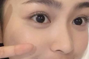 南昌大學二附院醫(yī)療美容科整形價格表(價目表)全新發(fā)布