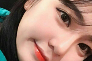 荊門市第一人民醫(yī)院醫(yī)學(xué)美容中心整形價格表(價目表)一覽及醫(yī)院介紹