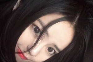 華西醫(yī)院整形美容燒傷科整形價格表(價目表)全新發(fā)布