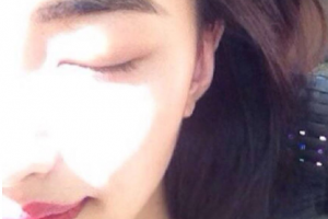 恩施州中心醫(yī)院燒傷整形醫(yī)療美容科整形價格表(價目表)一覽及醫(yī)院介紹