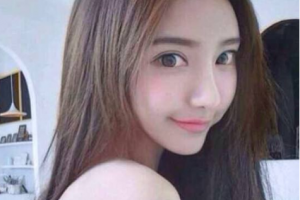 建湖縣中醫(yī)院整形價格表(價目表)一覽及醫(yī)院介紹