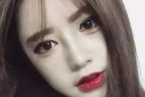 2020成都晶膚醫(yī)院整形價(jià)格表(價(jià)目表)公布