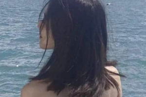 深圳明倫整形美容醫(yī)院整形價(jià)格表(價(jià)目表)2020全新發(fā)布