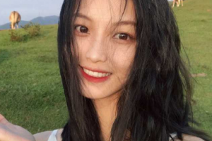 北京大學(xué)第三醫(yī)院美容整形科整形價(jià)格表(價(jià)目表)2020全新發(fā)布