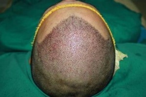 重慶真伊醫(yī)院毛發(fā)種植美容整形科整形價格表(價目表)2020全新發(fā)布