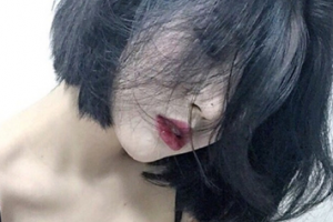 武漢協(xié)和醫(yī)院美容整形科整形價(jià)格表(價(jià)目表)2020全新發(fā)布