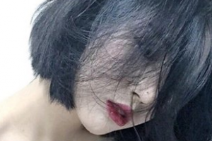 2020成都今妃醫(yī)學(xué)美容診所整形價格表(價目表)全新發(fā)布