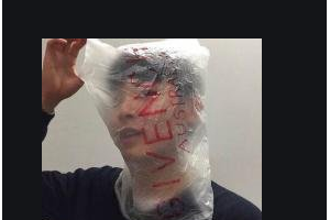 2020長(zhǎng)沙佰佳麗醫(yī)療美容門診部整形價(jià)格表(價(jià)目表)全新發(fā)布