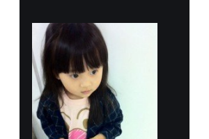 2020南充達芬奇醫(yī)療美容門診部整形價格表(價目表)全新發(fā)布