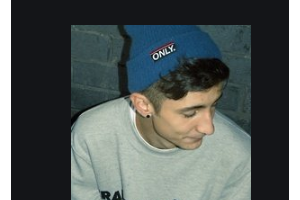 2020孝感君雅口腔門診整形價格表(價目表)全新發(fā)布