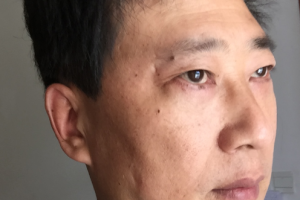 2020楚雄州人民醫(yī)院眼科整形價格表(價目表)全新發(fā)布