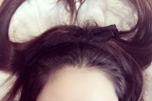 腿部吸脂了解一下！