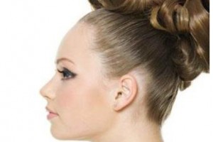 什么是隱耳，隱耳如何矯正