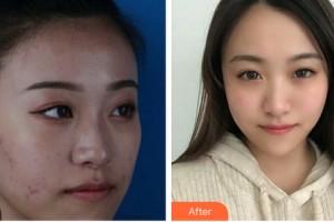 沈陽金皇后整形美容醫(yī)院彭柏勝整形價(jià)格表附皮膚美容案例展示