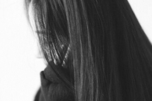 上海美侖醫(yī)療美容門診部楊松林整形價(jià)格表附鼻部硅膠假體取出案例展示