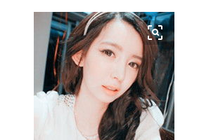 上海仁濟(jì)醫(yī)院整形外科陸毅整形價(jià)格表附肋軟骨隆鼻案例展示