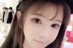 上海美之源整形外科醫(yī)院滕可穎整形價格表附光子嫩膚案例展示