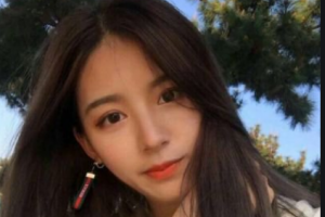 上海紐賽醫(yī)療美容門診部王琳整形價格表附玻尿酸全臉填充案例展示