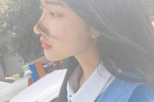 北京彤美美容整形醫(yī)院桂行軍整形價格表附玻尿酸精華導入案例展示