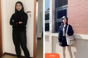 廣州醫(yī)學院第二附屬醫(yī)院整形美容中心張梅英整形價格表附美體塑形案例展示