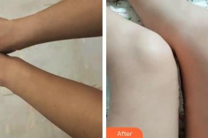 上海天大醫(yī)療美容醫(yī)院邱陽(yáng)整形價(jià)格表附注射美白案例展示