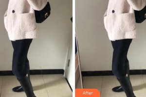 上海美立方整形醫(yī)院金洙喆整形價格表附吸脂·大腿吸脂案例展示