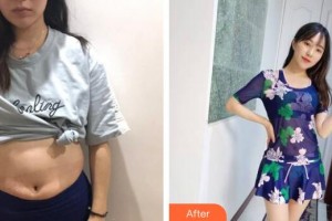 廣州遠東美容醫(yī)院袁欣整形價格表附美體塑形案例展示