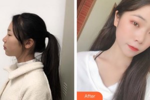 上海東方麗人美容醫(yī)療醫(yī)院谷曉輝整形價格表附超激光美膚祛斑美膚案例展示