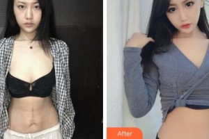 上海麗人整形美容醫(yī)院孔波整形價(jià)格表附激光手術(shù)祛疤案例展示