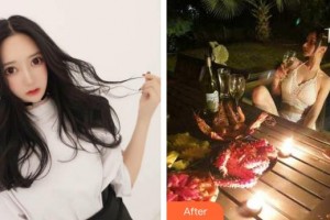 上?？祳W醫(yī)療美容醫(yī)院杭榆整形價(jià)格表附自體脂肪豐胸案例展示