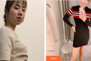 上海康奧醫(yī)療美容醫(yī)院何玉成整形價(jià)格表附光子套餐案例展示