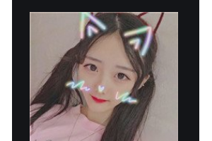 南京康美美容醫(yī)院杜永康整形價(jià)格表附肋軟骨隆鼻案例展示