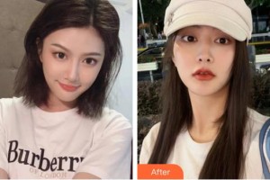 上海宏康醫(yī)院整形美容中心楊慶華整形價(jià)格表附面部熱瑪吉案例展示