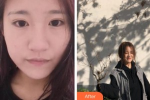 上海玫瑰醫(yī)療美容醫(yī)院吳曉麗整形價(jià)格表附無(wú)針?biāo)獍咐故?>
</a>
<h3 class=